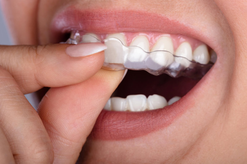 Olmito Orthodontics